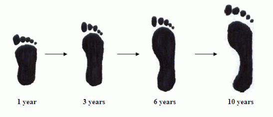 Weight distribution and appearance of the arch when growing up